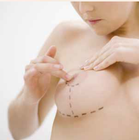 Estetická dermatologie: Třetina pacientek chce větší prsa